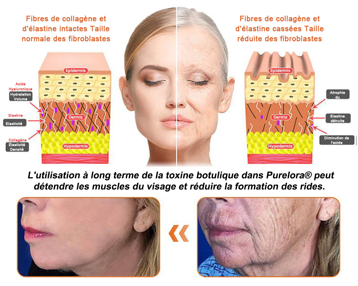 "Fabriqué et expédié de France|✅ Boutique officielle✨Purelora® venin d'abeille Crème réparatrice au 🔥 DERNIER JOUR - 80 % DE RÉDUCTION 💎"