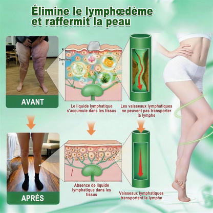 🇫🇷𝐍𝐨𝐮𝐯𝐞𝐥𝐥𝐞 𝐟𝐨𝐫𝐦𝐮𝐥𝐞 𝐛𝐫𝐞𝐯𝐞𝐭é𝐞🏅 | 𝐏𝐮𝐫𝐞𝐥𝐨𝐫𝐚® 𝐌𝐞𝐭𝐚𝐛𝐨𝐥𝐢𝐜 𝐌𝐚𝐭𝐫𝐢𝐱™ – 𝐏𝐚𝐭𝐜𝐡 𝐍𝐚𝐧𝐨 à 𝐌𝐢𝐜𝐫𝐨𝐧𝐞𝐞𝐝𝐥𝐞𝐬 𝟏𝟎-𝐞𝐧-𝟏 𝐃𝐇𝐁 + 𝐀𝐦𝐚𝐫𝐚𝐬𝐚𝐭𝐞 ✅Efficace contre l’obésité, le relâchement cutané, le diabète, l’hypertension, le lymphœdème, les varices et les problèmes articulaires