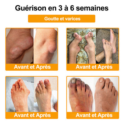 Purelora®🔥 Crème apaisante et cicatrisante pour les os au venin d'abeille et au lithospermum 👑👑 (spécialement conçue pour les personnes âgées)