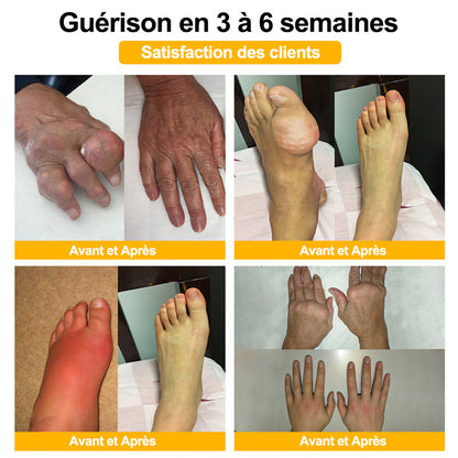 Purelora®🔥 Crème apaisante et cicatrisante pour les os au venin d'abeille et au lithospermum 👑👑 (spécialement conçue pour les personnes âgées)
