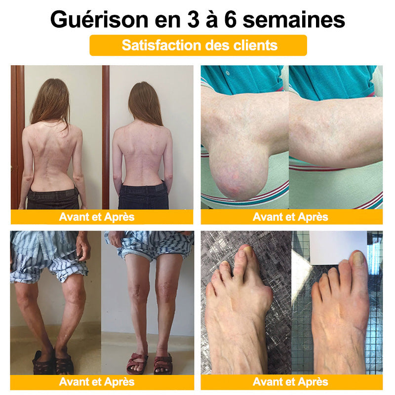 Purelora®🔥 Crème apaisante et cicatrisante pour les os au venin d'abeille et au lithospermum 👑👑 (spécialement conçue pour les personnes âgées)