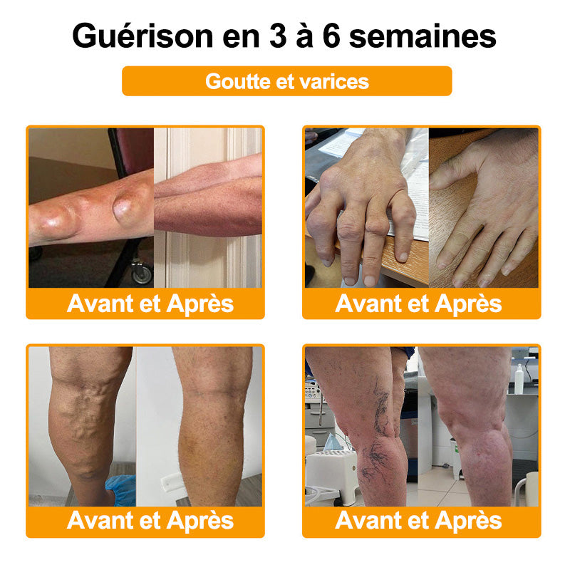 Purelora®🔥 Crème apaisante et cicatrisante pour les os au venin d'abeille et au lithospermum 👑👑 (spécialement conçue pour les personnes âgées)