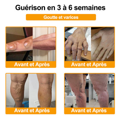 Purelora®🔥 Crème apaisante et cicatrisante pour les os au venin d'abeille et au lithospermum 👑👑 (spécialement conçue pour les personnes âgées)