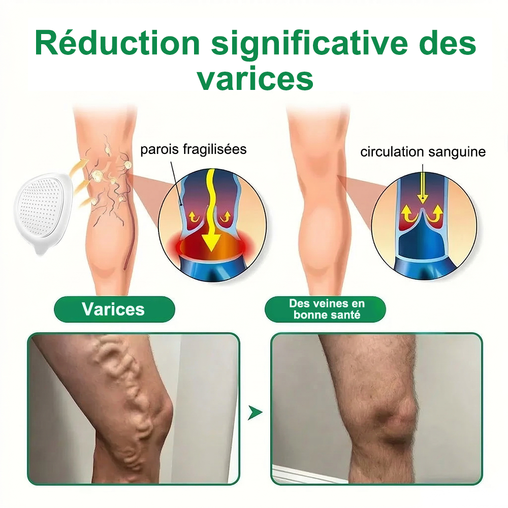 🇫🇷𝐍𝐨𝐮𝐯𝐞𝐥𝐥𝐞 𝐟𝐨𝐫𝐦𝐮𝐥𝐞 𝐛𝐫𝐞𝐯𝐞𝐭é𝐞🏅 | 𝐏𝐮𝐫𝐞𝐥𝐨𝐫𝐚® 𝐌𝐞𝐭𝐚𝐛𝐨𝐥𝐢𝐜 𝐌𝐚𝐭𝐫𝐢𝐱™ – 𝐏𝐚𝐭𝐜𝐡 𝐍𝐚𝐧𝐨 à 𝐌𝐢𝐜𝐫𝐨𝐧𝐞𝐞𝐝𝐥𝐞𝐬 𝟏𝟎-𝐞𝐧-𝟏 𝐃𝐇𝐁 + 𝐀𝐦𝐚𝐫𝐚𝐬𝐚𝐭𝐞 ✅Efficace contre l’obésité, le relâchement cutané, le diabète, l’hypertension, le lymphœdème, les varices et les problèmes articulaires