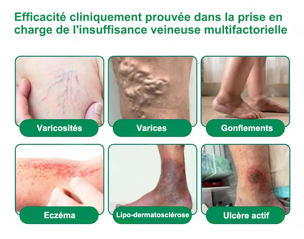 🇫🇷𝐍𝐨𝐮𝐯𝐞𝐥𝐥𝐞 𝐟𝐨𝐫𝐦𝐮𝐥𝐞 𝐛𝐫𝐞𝐯𝐞𝐭é𝐞🏅 | 𝐏𝐮𝐫𝐞𝐥𝐨𝐫𝐚® 𝐌𝐞𝐭𝐚𝐛𝐨𝐥𝐢𝐜 𝐌𝐚𝐭𝐫𝐢𝐱™ – 𝐏𝐚𝐭𝐜𝐡 𝐍𝐚𝐧𝐨 à 𝐌𝐢𝐜𝐫𝐨𝐧𝐞𝐞𝐝𝐥𝐞𝐬 𝟏𝟎-𝐞𝐧-𝟏 𝐃𝐇𝐁 + 𝐀𝐦𝐚𝐫𝐚𝐬𝐚𝐭𝐞 ✅Efficace contre l’obésité, le relâchement cutané, le diabète, l’hypertension, le lymphœdème, les varices et les problèmes articulaires