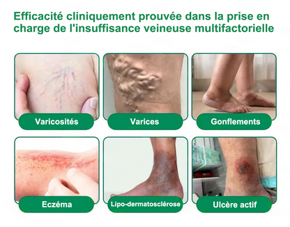 🇫🇷𝐍𝐨𝐮𝐯𝐞𝐥𝐥𝐞 𝐟𝐨𝐫𝐦𝐮𝐥𝐞 𝐛𝐫𝐞𝐯𝐞𝐭é𝐞🏅 | 𝐏𝐮𝐫𝐞𝐥𝐨𝐫𝐚® 𝐌𝐞𝐭𝐚𝐛𝐨𝐥𝐢𝐜 𝐌𝐚𝐭𝐫𝐢𝐱™ – 𝐏𝐚𝐭𝐜𝐡 𝐍𝐚𝐧𝐨 à 𝐌𝐢𝐜𝐫𝐨𝐧𝐞𝐞𝐝𝐥𝐞𝐬 𝟏𝟎-𝐞𝐧-𝟏 𝐃𝐇𝐁 + 𝐀𝐦𝐚𝐫𝐚𝐬𝐚𝐭𝐞 ✅Efficace contre l’obésité, le relâchement cutané, le diabète, l’hypertension, le lymphœdème, les varices et les problèmes articulaires