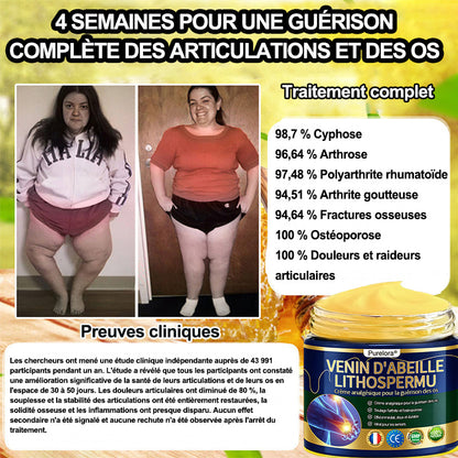 Purelora®🔥 Crème apaisante et cicatrisante pour les os au venin d'abeille et au lithospermum 👑👑 (spécialement conçue pour les personnes âgées)
